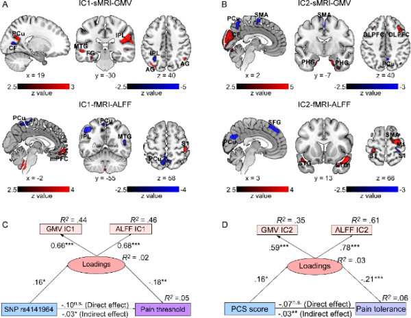 中科院：发现中介遗传和心理调节疼痛敏感性的多模态共变脑模式